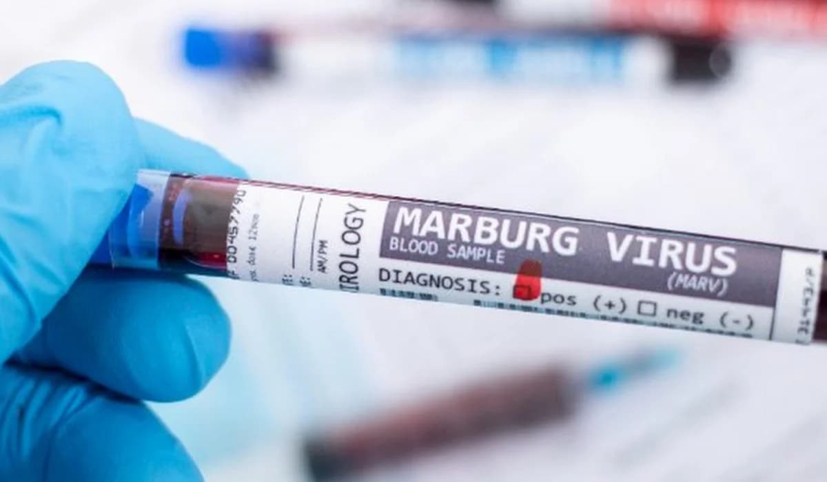 Health Ministry Announces Guidelines for Prevention of Marburg Virus Disease