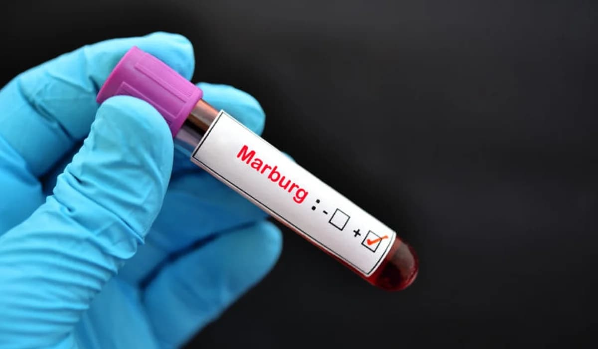 Marburg: No New Cases in Seven Consecutive Days