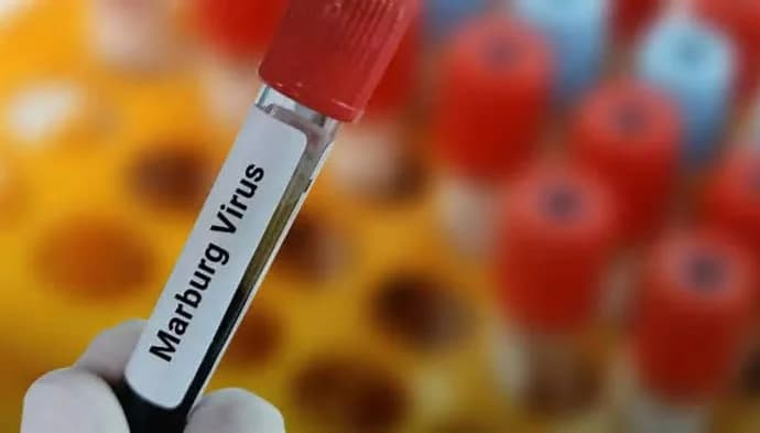 Rwanda Confirms the Exact Origin of Marburg Virus Outbreak