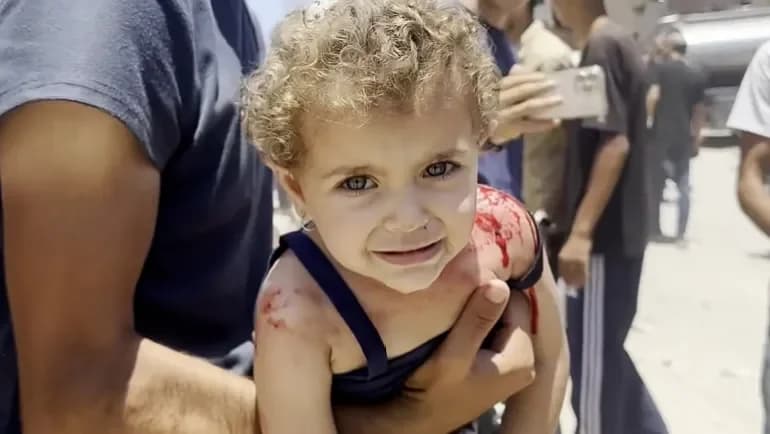 Thousands of Gaza children need urgent medical evacuation as death toll rises