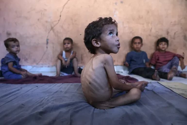 "At least 154 dead," malnutrition death toll rises in Gaza as hunger crisis escalates