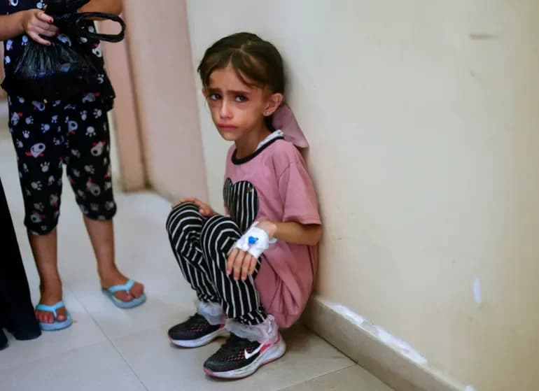 7 New Child Malnutrition Cases in Gaza as Israel Keeps Blocking Humanitarian Aid